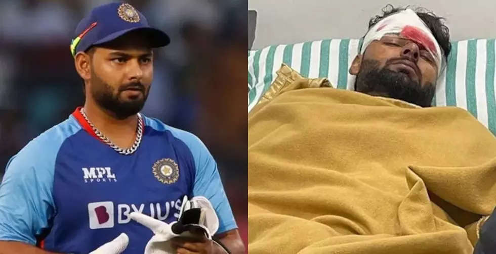 rishabh pant car crash, રિશભ પંતને એરલિફ્ટ કરી મુંબઈ લવાશે, નિષ્ણાંત ડોક્ટરની દેખરેખમાં થશે તેની સર્જરી - car crash rishabh pant airlifted to mumbai and set to undrgo surgery says bcci